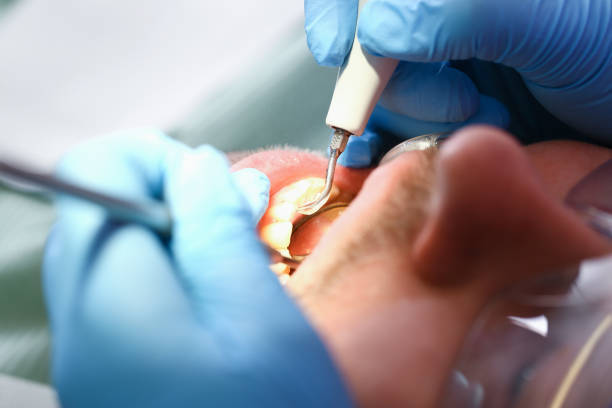 Best Emergency Treatment for Oral Infections in Corinth, MS