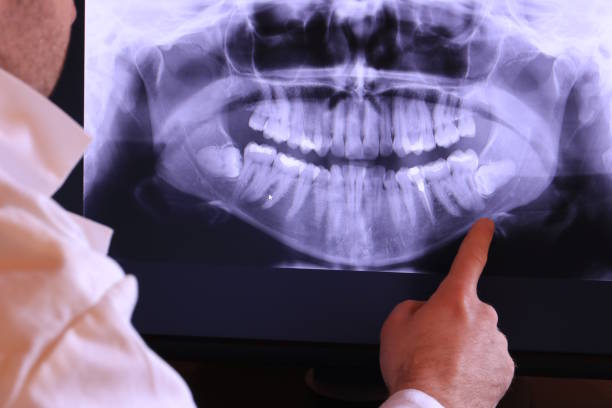Best Emergency Cosmetic Dentistry (e.g., broken veneers) in Corinth, MS